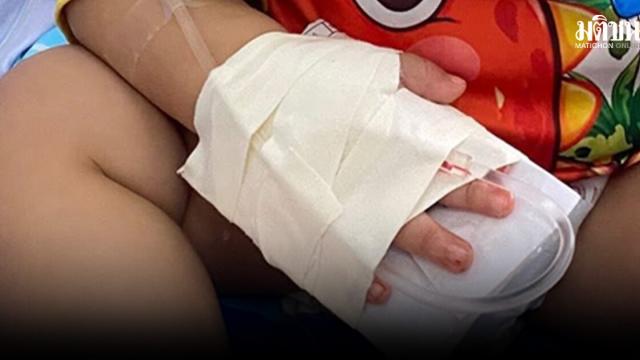 Investigation Underway After Infant Suffers Injury During Medical Procedure
