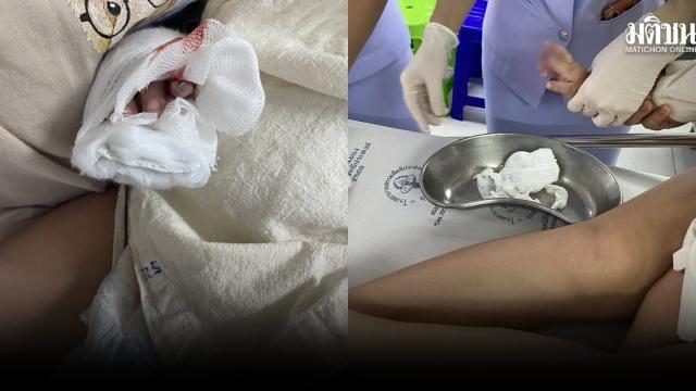 Dibattito sulla sicurezza medica: l'uso di forbici nella rimozione di flebo pediatriche