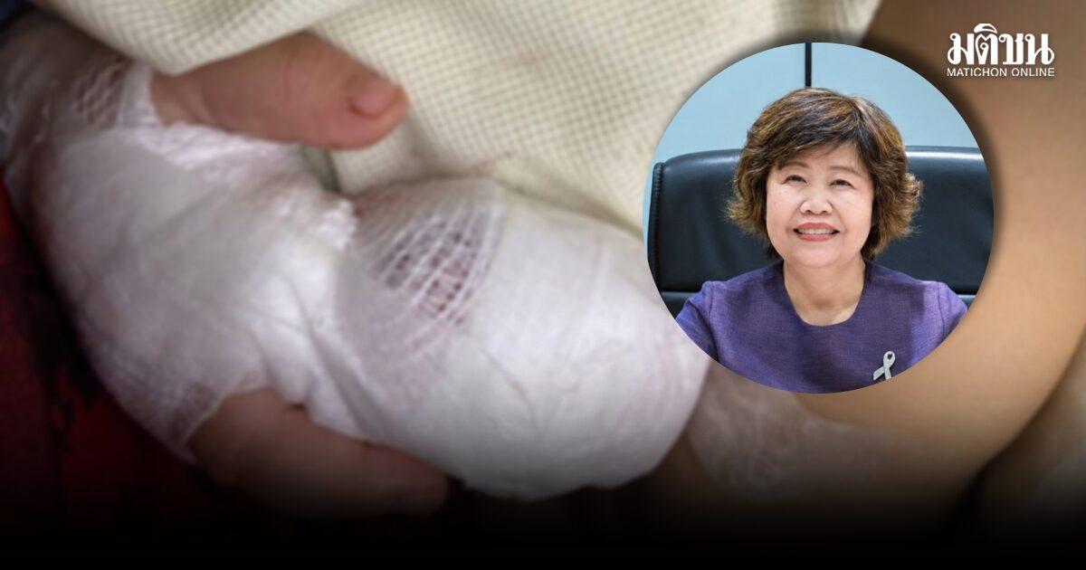 NHSO Clarifies Compensation Status for 'Nong Ufa' Case