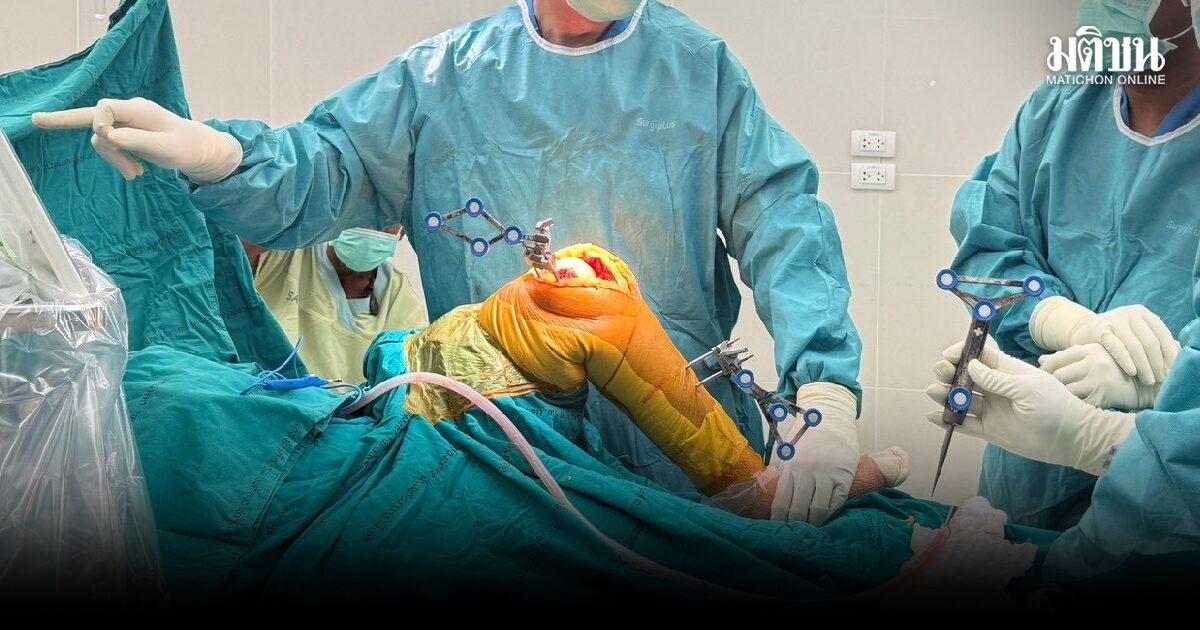 Nopparat Rajathanee Hospital Introduces Robotic Knee Replacement Surgery