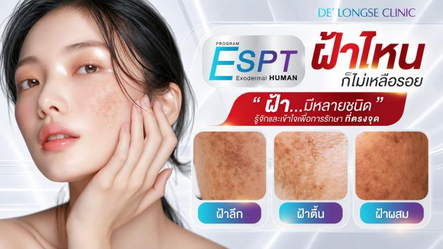 Understanding Recurrent Melasma: Insights from DE’ Longse Clinic