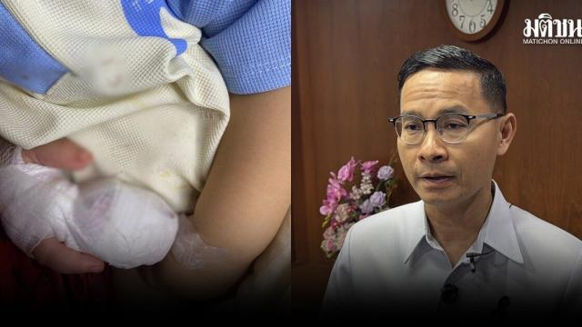 Yasothon Health Official Confirms Hospital Responsibility in Child Injury Case