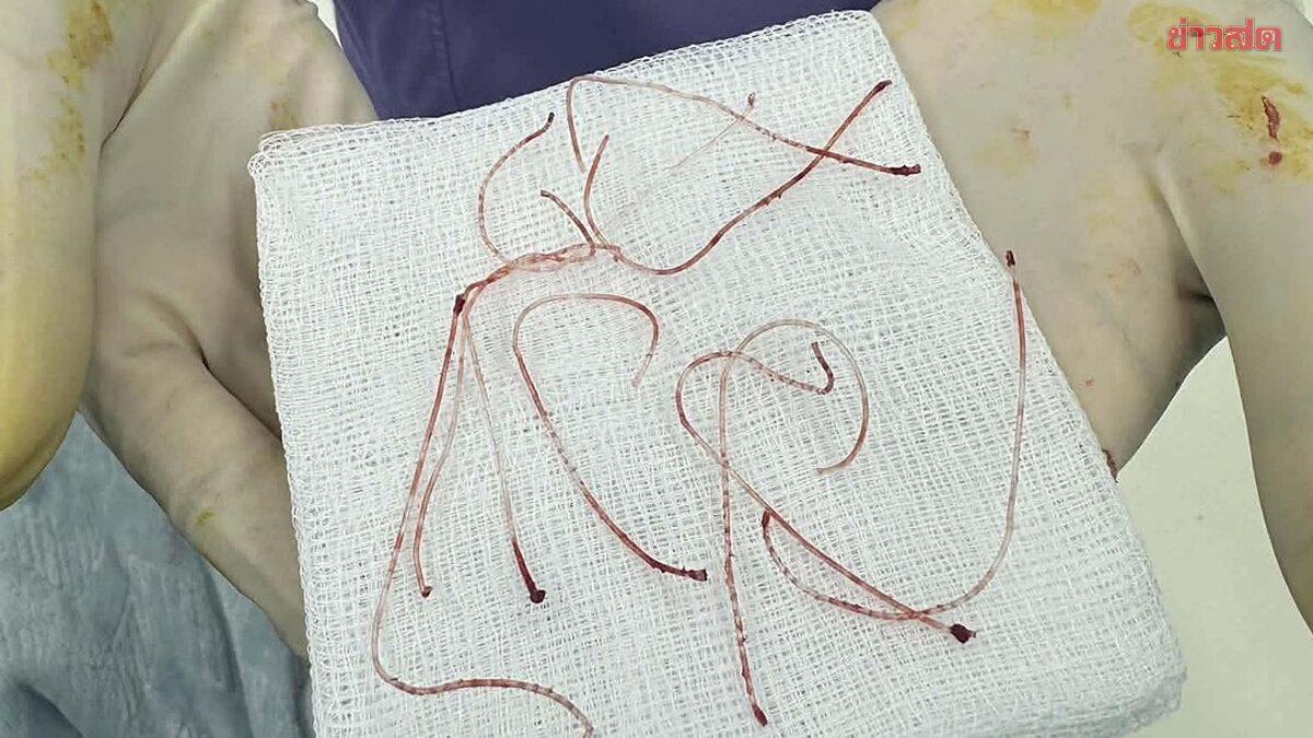 Une clinique de beauté de Phatthalung fait face à des plaintes pour faute professionnelle présumée