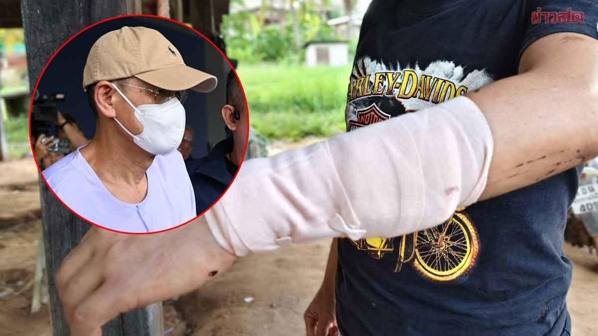 Domestic Dispute in Buriram Leads to Injury