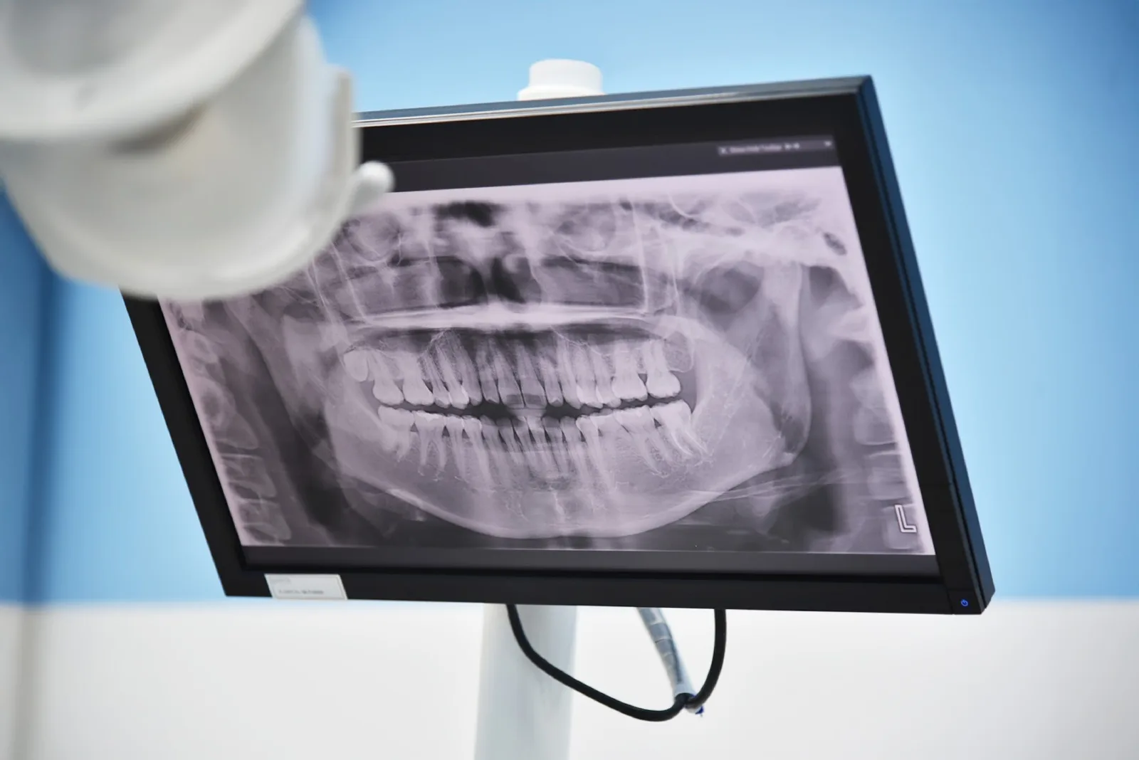 Photo gallery — Smile Signature